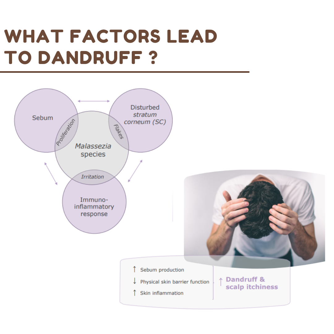 NO ITCH, NO FALKES, JUST A HEALTHY SCALP AND  BEAUTIFUL HAIR