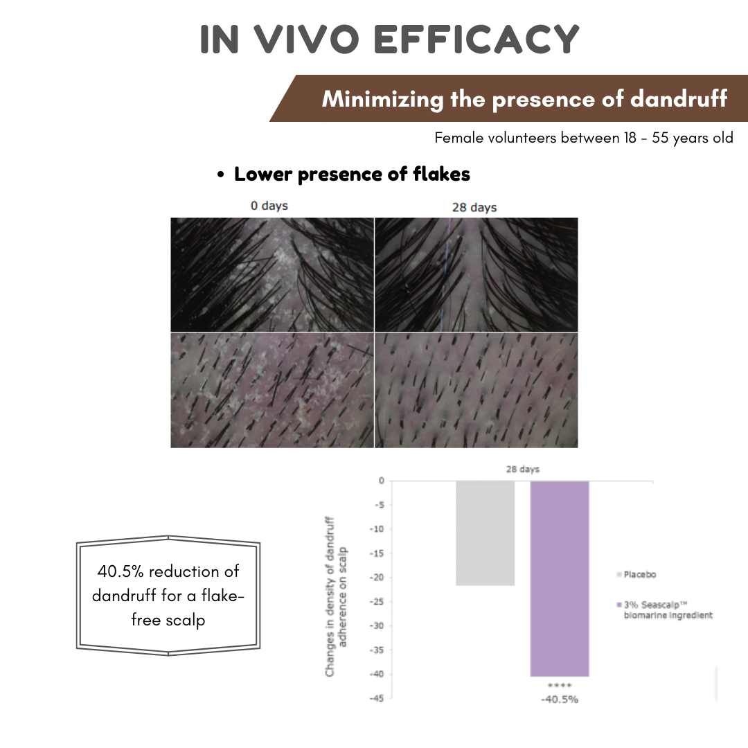 NO ITCH, NO FALKES, JUST A HEALTHY SCALP AND  BEAUTIFUL HAIR