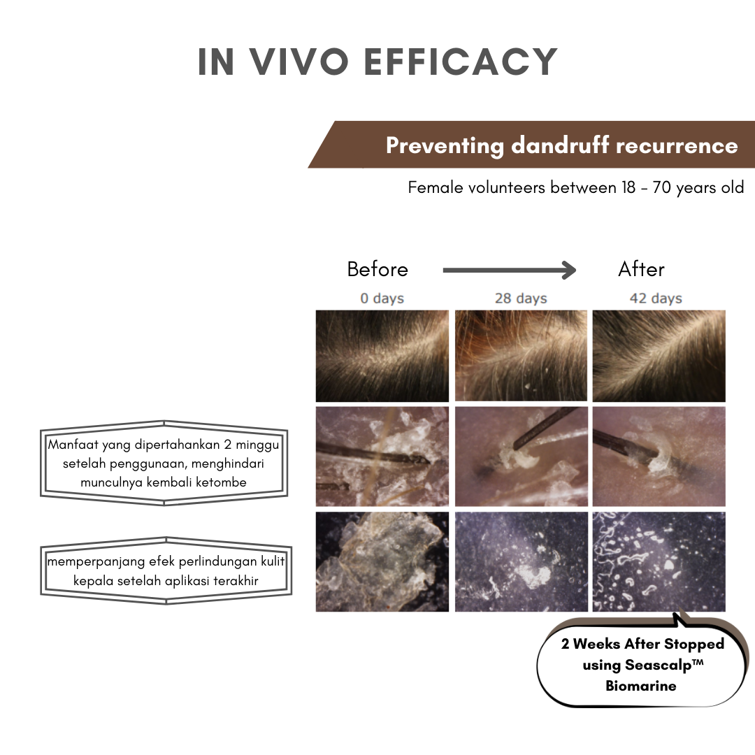 NO ITCH, NO FALKES, JUST A HEALTHY SCALP AND  BEAUTIFUL HAIR