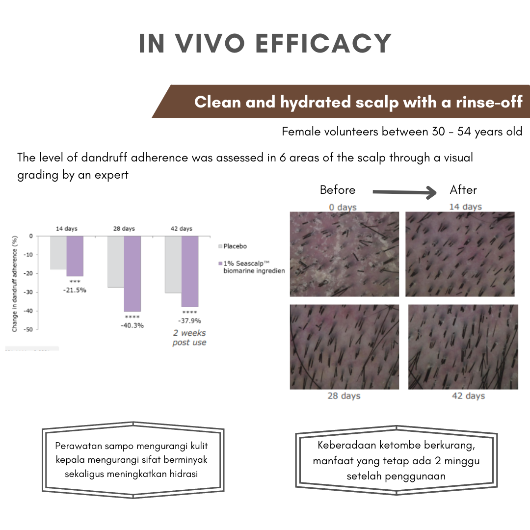 NO ITCH, NO FALKES, JUST A HEALTHY SCALP AND  BEAUTIFUL HAIR