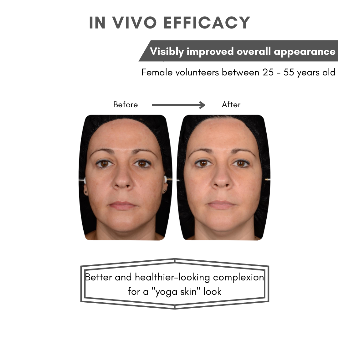 OXYLANCE™ ADVANCED BOTANICAL INGREDIENT